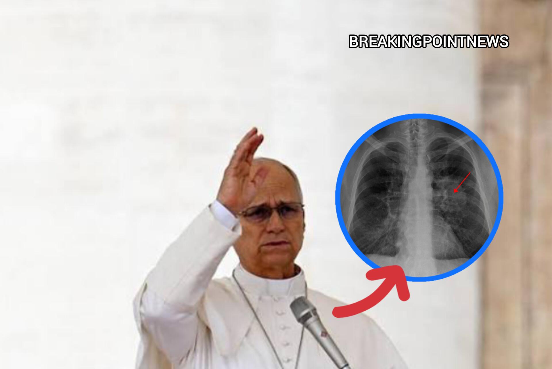 Pope Leo XIV Diagnosed with Cancer After Emergency Lung Surgery Vatican Reveals Latest Update